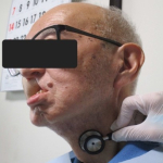 dysphagia3.jpg