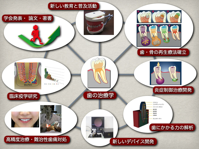 口腔保存治療学分野の研究概要